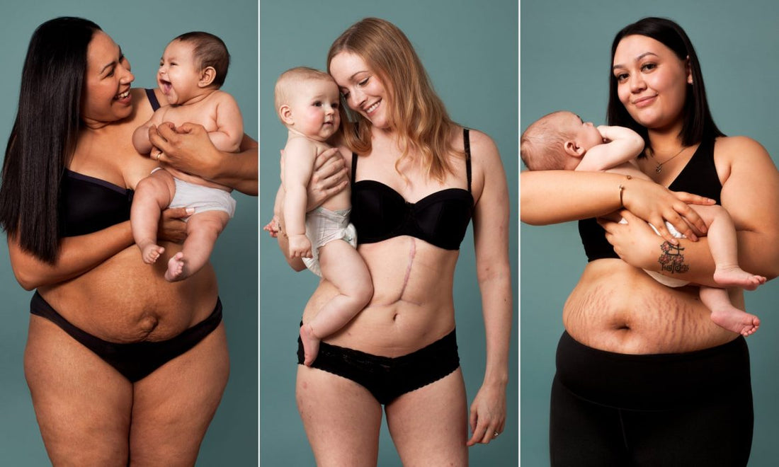 La pancia dopo il parto: Perché cambia e come tonificarla - Intimo modellante snellente contenitivo donna
